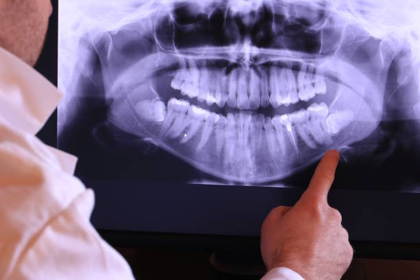 Best Emergency Tooth Extraction  in Seacliff, CA